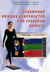 Поражения нижних конечностей при сахарном диабете