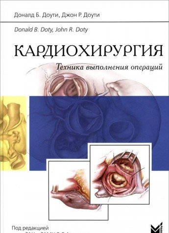 Кардиохирургия. Техника выполнения операций