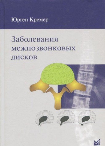 Заболевания межпозвонковых дисков. 2-е изд.