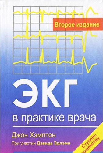 ЭКГ в практике врача