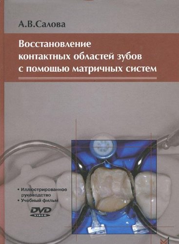 Восстановление контактных областей зубов с помощью матричных систем
