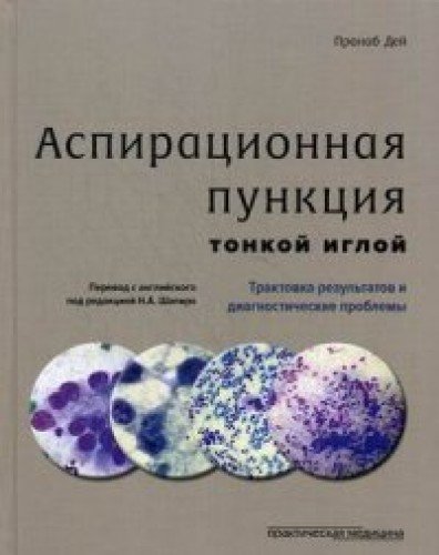 Аспирационная пункция тонкой иглой.Трактов.результ