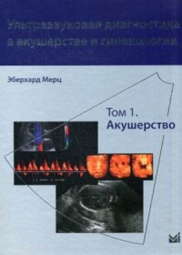 Ультразвуковая диагностика в акушерстве и гинекологии.т.1. 2-е изд.