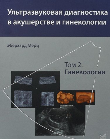 Ультразвуковая диагностика в акушерстве и гинекологии.т.2. Гинекология 2-е изд,
