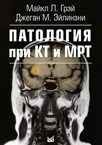 Патология при КТ и МРТ. 2-е изд.