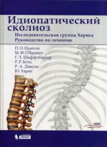 Идиопатический сколиоз. Исследовател.группа Хармса