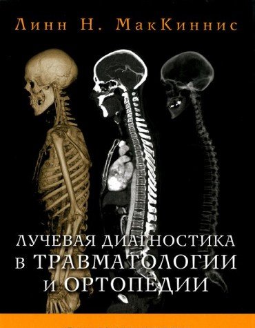 Лучевая диагностика в травматологии и ортопедии