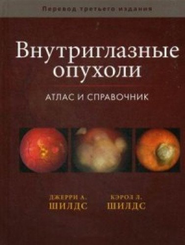 Внутриглазные опухоли. Атлас и справочник