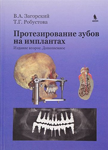 Протезирование зубов наимплантантах. изд.2-е