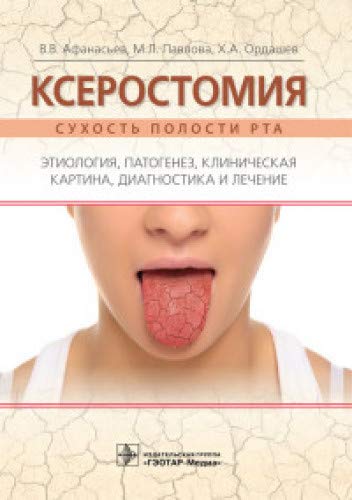 Ксеростомия (сухость полости рта).Этиология,патогенез,клинич.картина,диагн-ка и