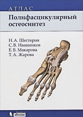 Полифасцикулярный остеосинтез: Атлас