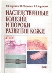 Наследствен.болезни и пороки развития кожи. Атлас