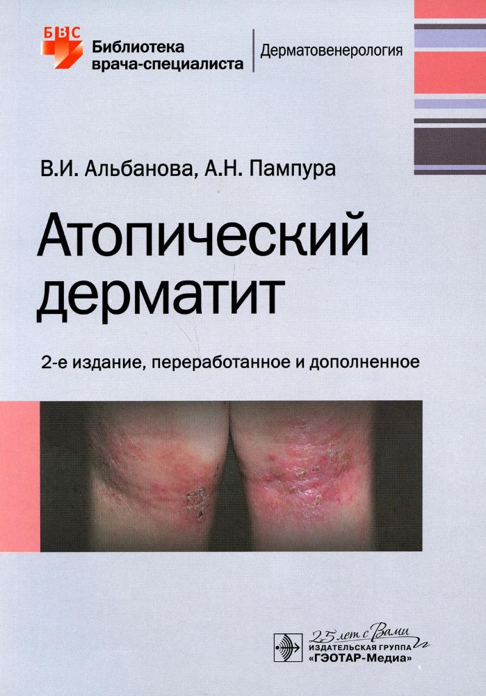 Атопический дерматит (2-е изд.)