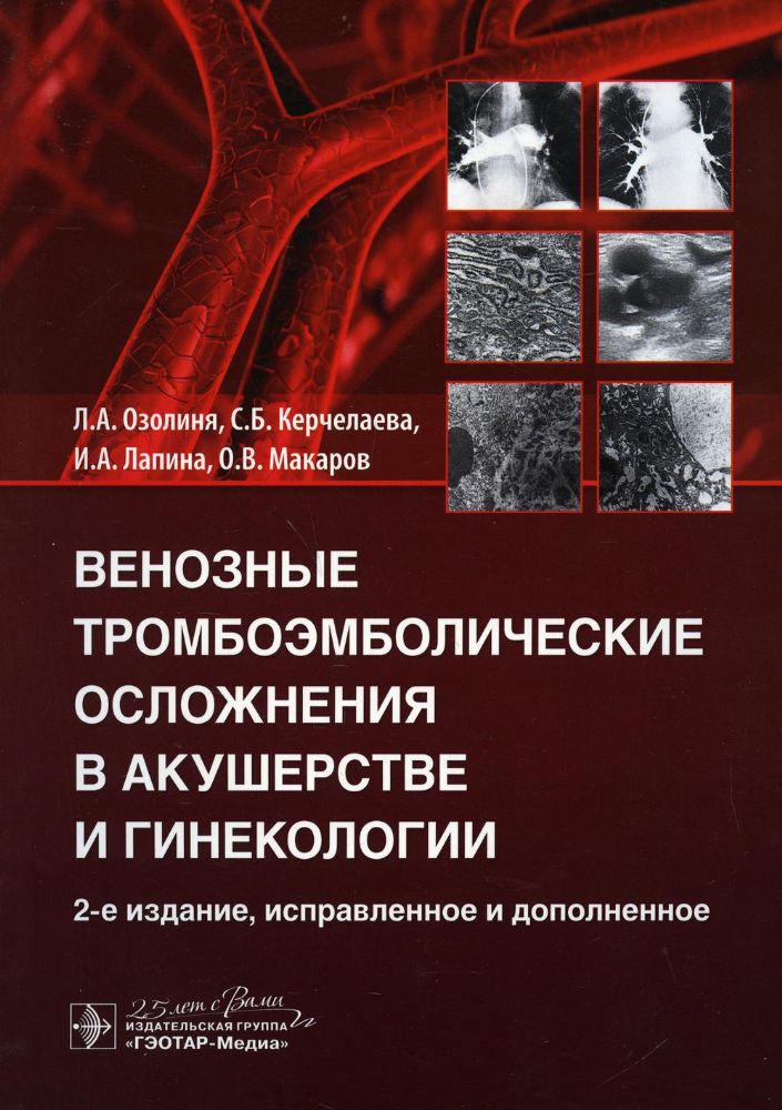 Венозные тромбоэмболические осложнения в акушерстве и гинекологии (2-е изд.)