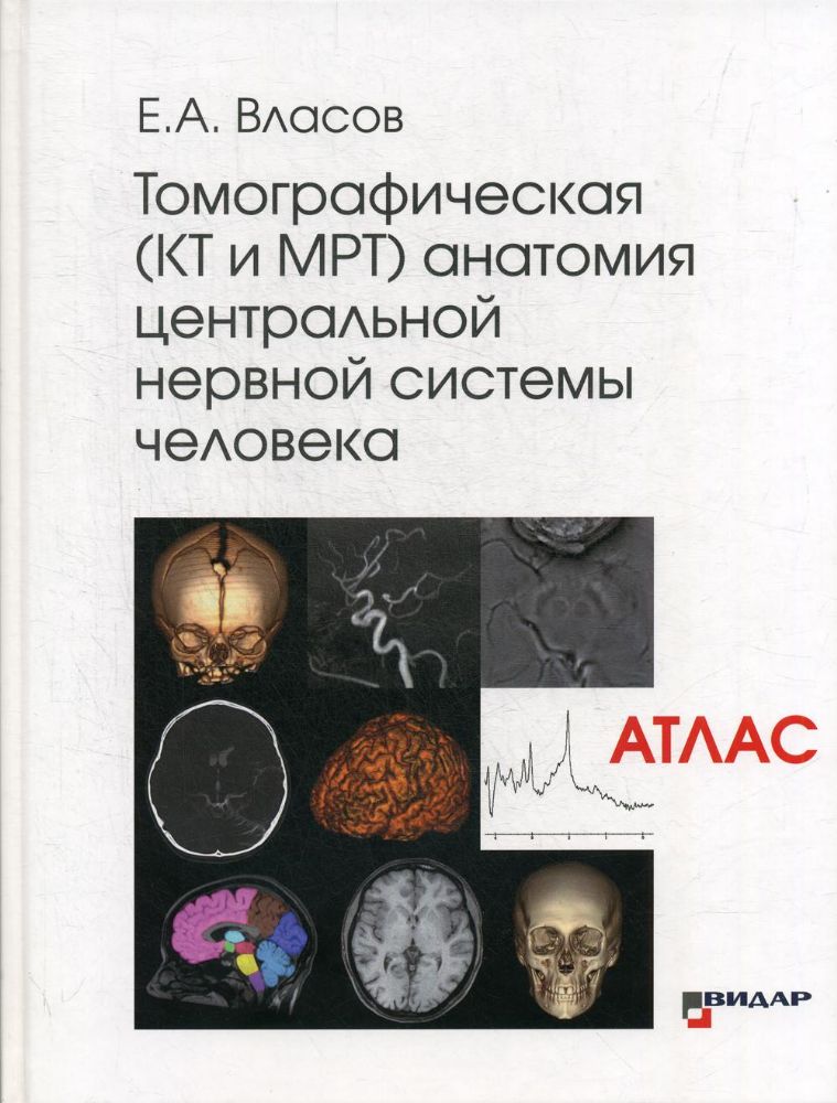 Томографическая (КТ и МРТ) анатомия центральной нервной системы человека (Атлас)