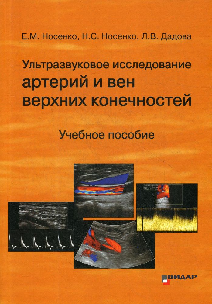 Ультразвуковое исследование артерий и вен верхних конечностей: Учебное пособие