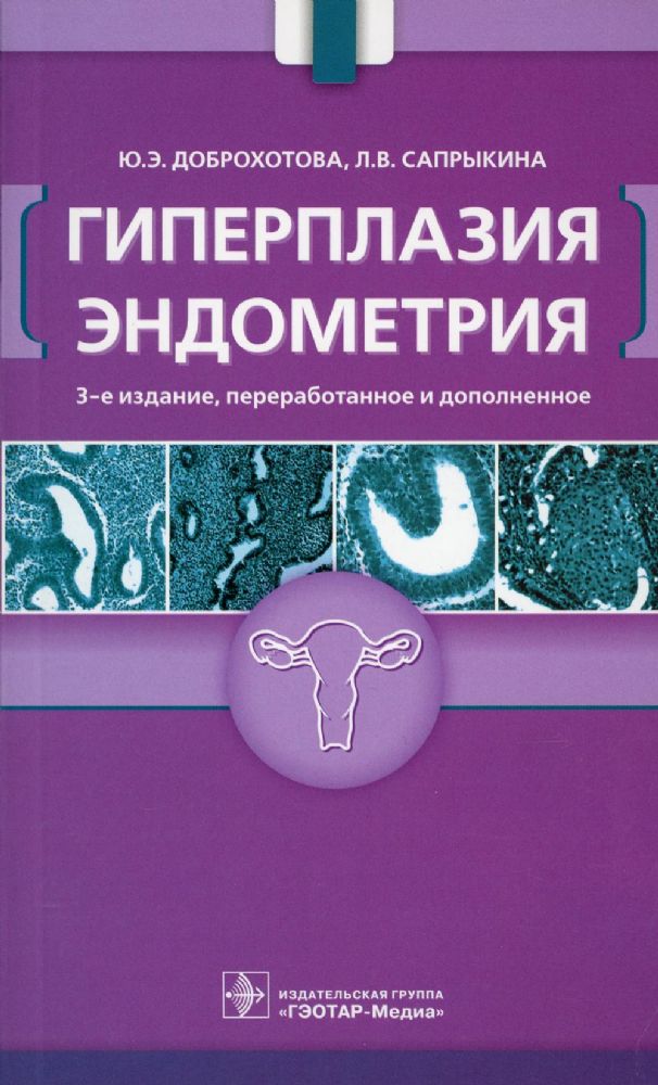 Гиперплазия эндометрия. 3-е изд., перераб. и доп
