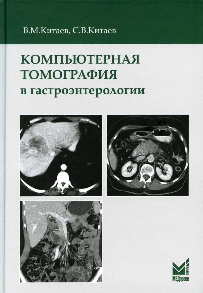 Компьютерная томография в гастроэнтерологии. 2-е изд