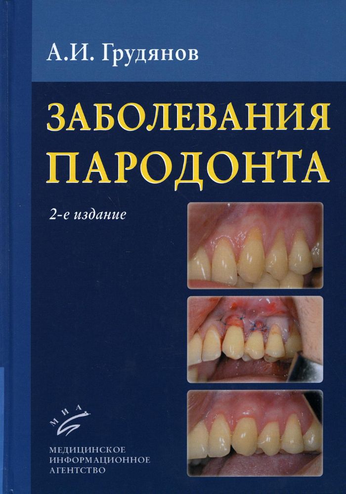 Заболевания пародонта : Учебно-методическое руководство. 2-е изд., доп.и перераб