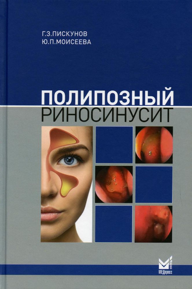 Полипозный риносинусит. 2-е изд., доп