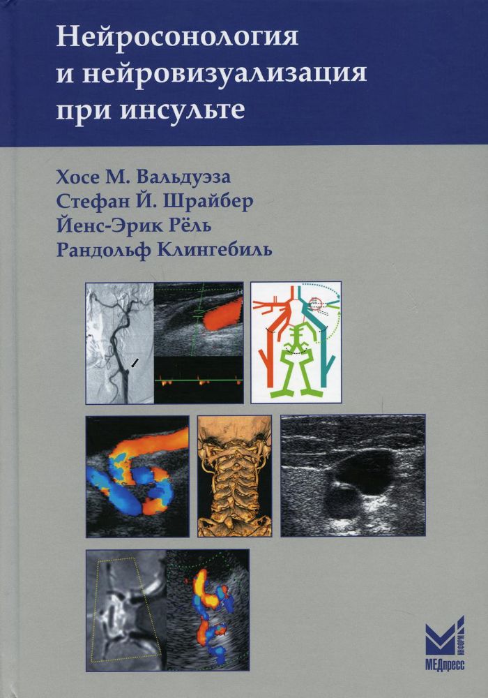 Нейросонология и нейровизуализация при инсульте. 2-е изд