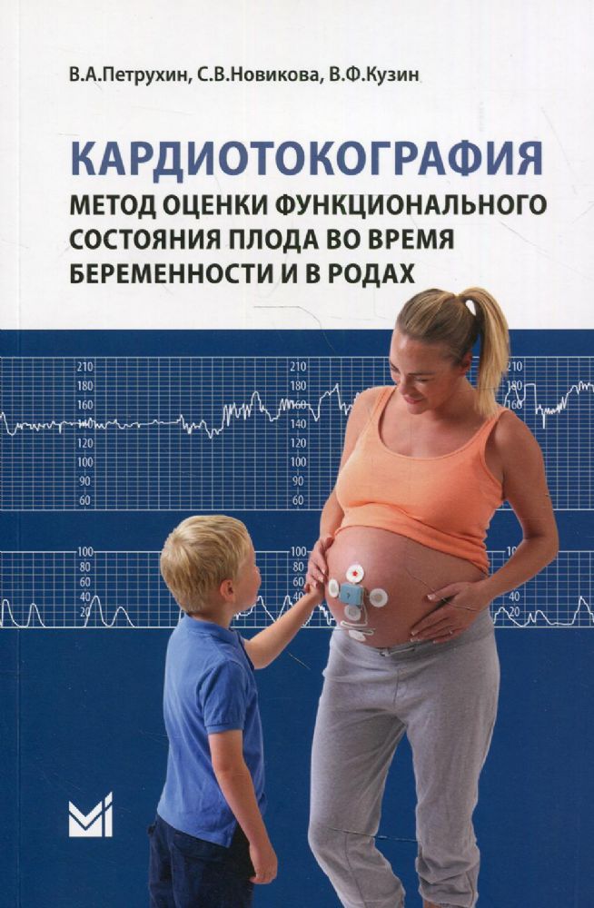 Кардиотокография. Метод оценки функционального состояния плода во время беременности и в родах: Учебное пособие