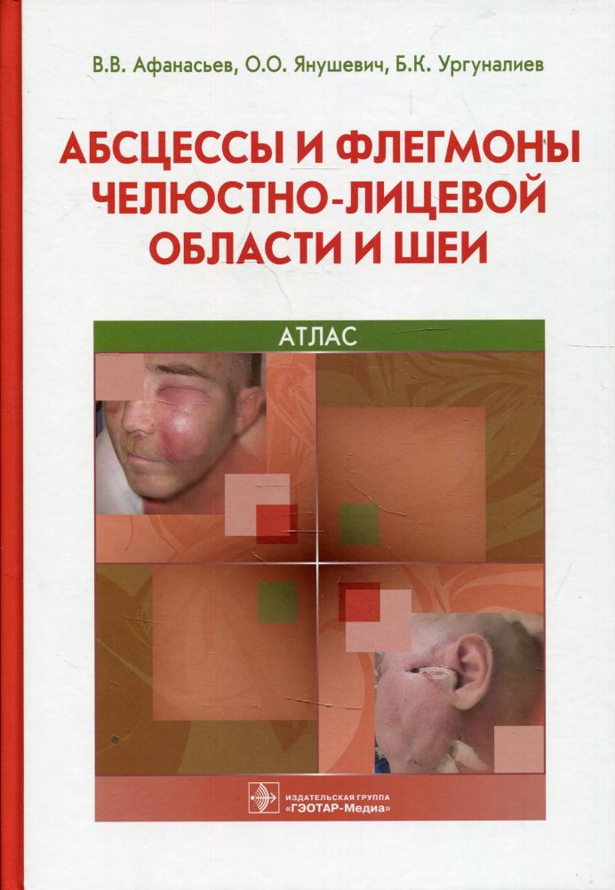 Абсцессы и флегмоны челюстно-лицевой области и шеи. Атлас: учебное пособие