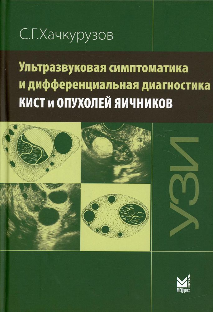 Ультразвуковая симптоматика и дифференциальная диагностика кист и опухолей яичников. 2-е изд