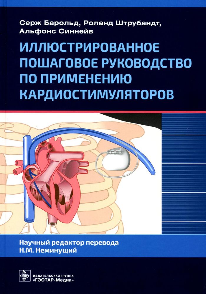 Иллюстрированное пошаговое руководство по применению кардиостимуляторов