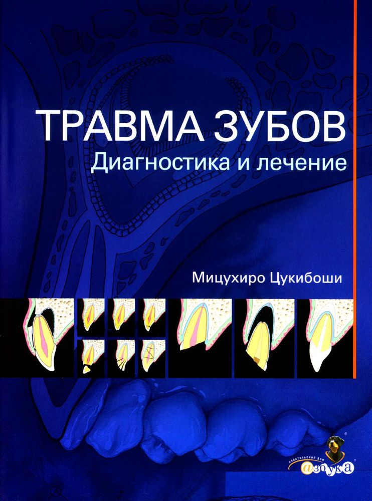 Цукибоши М. Травма зубов. Диагностика и лечение/М.Цукибоши - М.:Азбука стоматолога, 2019.