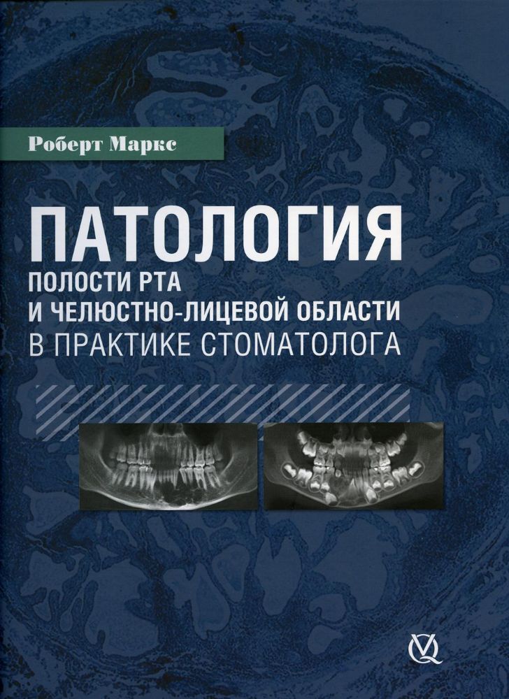 Р. Маркс Патология полости рта в практике стоматолога