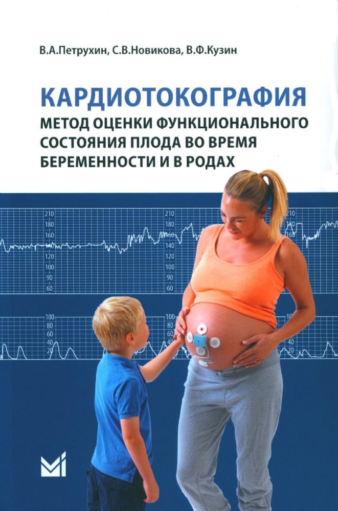 Кардиотокография - метод оценки функционального состояния плода во время беременности: Учебное пособие. 2-е изд