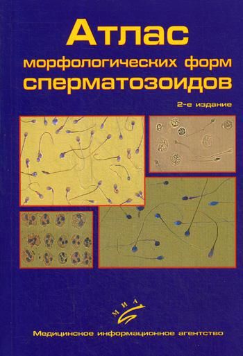 Атлас морфологических форм сперматозоидов. 2-е изд., доп