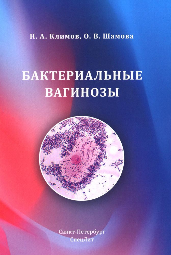 Бактериальные вагинозы