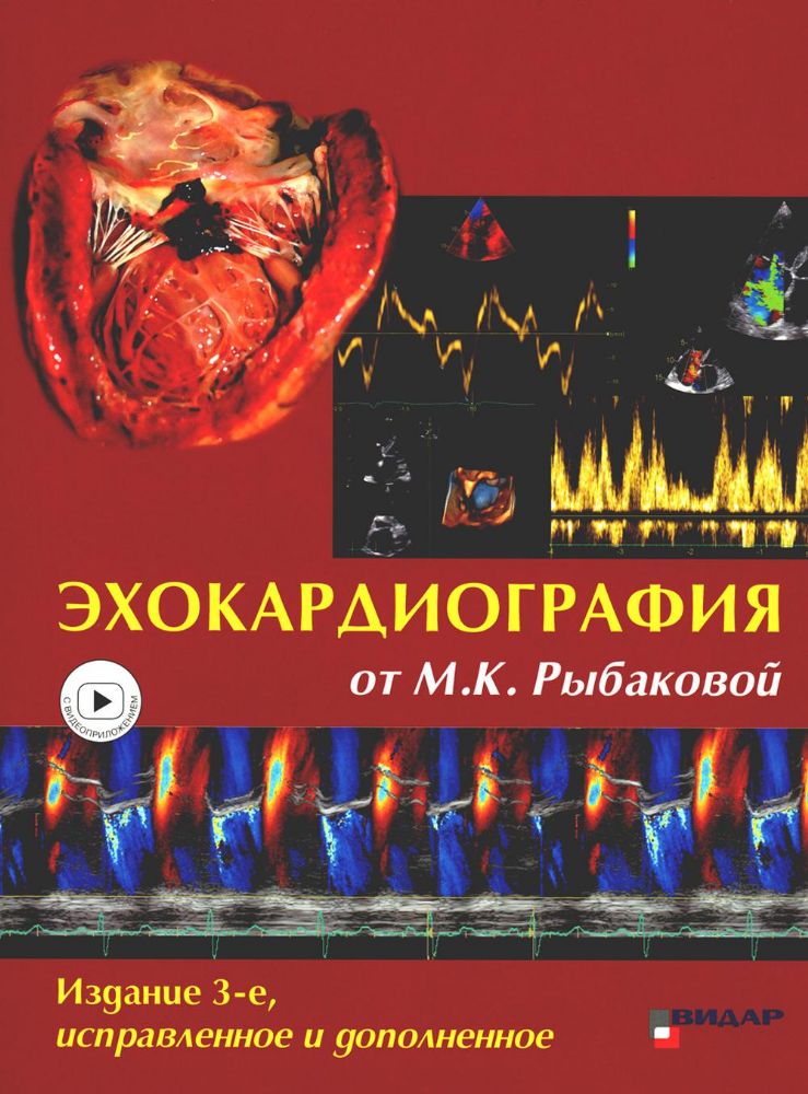 Эхокардиография от М.К. Рыбаковой: Руководство: с приложением. 3-е изд., испр.и доп (ссылка на видеоматериалы)