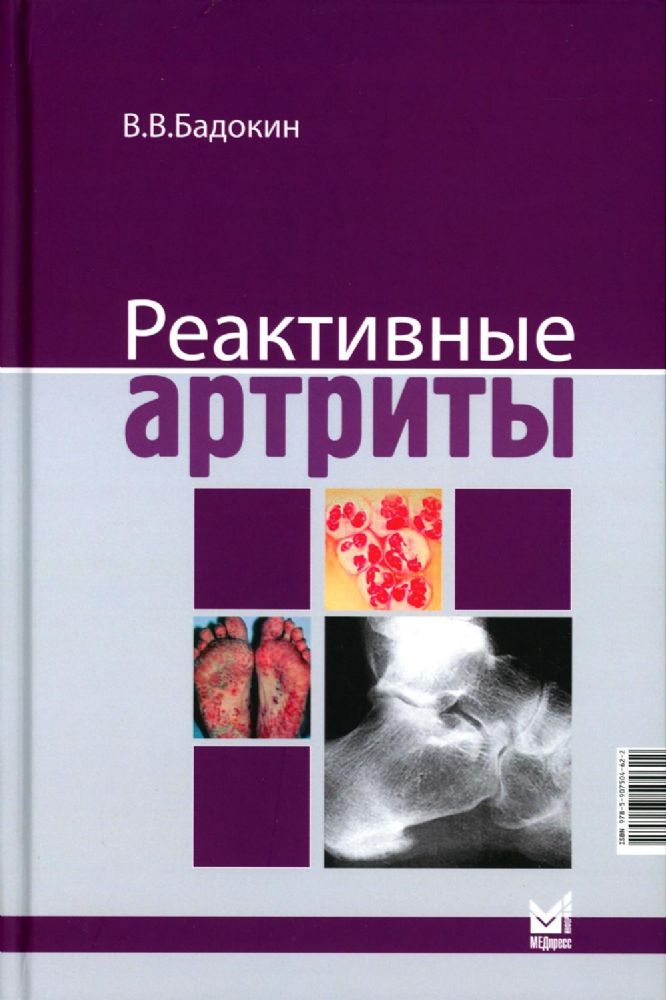 Реактивные артриты. Урогенитальные и постэнтероколитические. 2-е изд