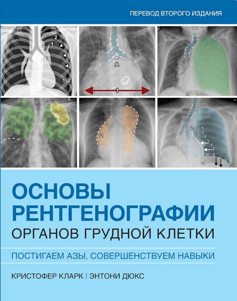 Основы рентгенографии органов грудной клетки