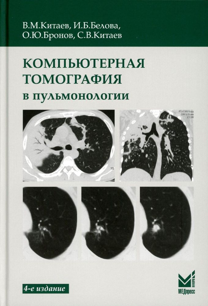 Компьютерная томография в пульмонологии. 4-е изд