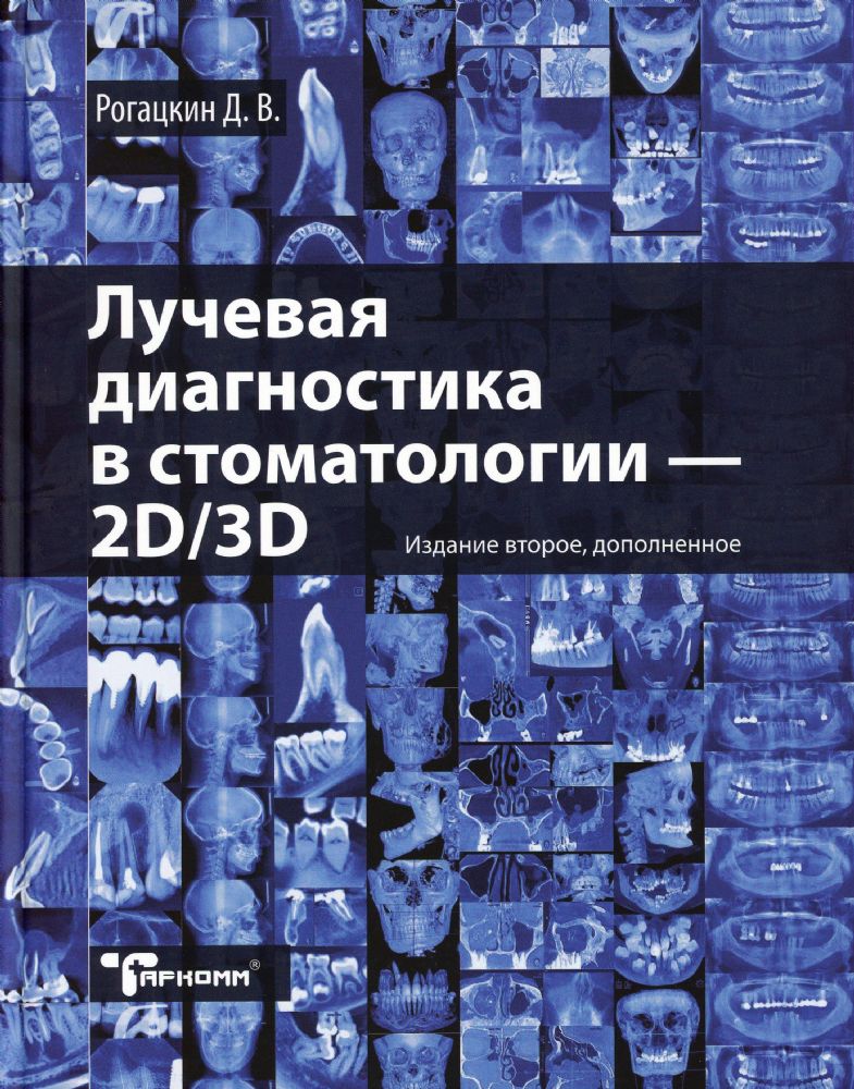Лучевая диагностика в стоматологии: 2D/3D. 2-е изд., доп
