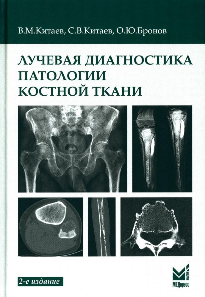 Лучевая диагностика патологии костной ткани. 2-е изд