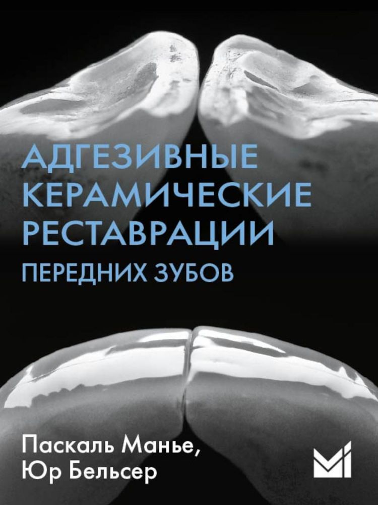 Адгезивные керамические реставрации передних зубов. 4-е изд