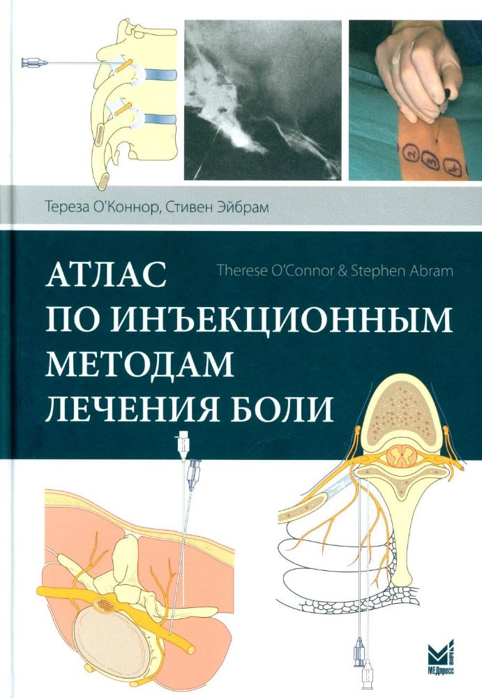 Атлас по инъекционным методам лечения боли. 2-е изд