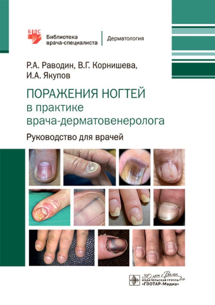 Поражения ногтей в практике врача-дерматовенеролога: руководство для врачей