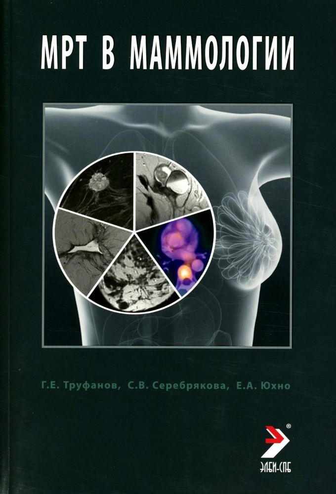 МРТ в маммологии: руководство для врачей