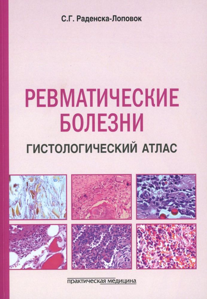 Ревматические болезни. Гистологический атлас