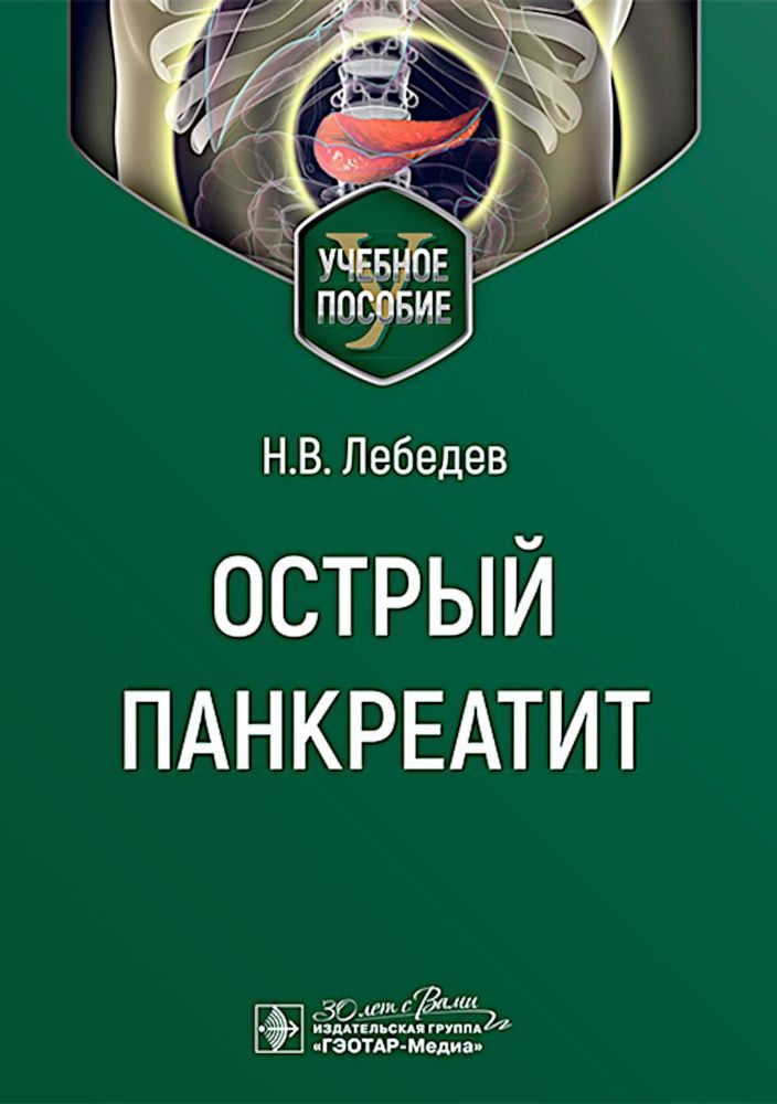 Острый панкреатит