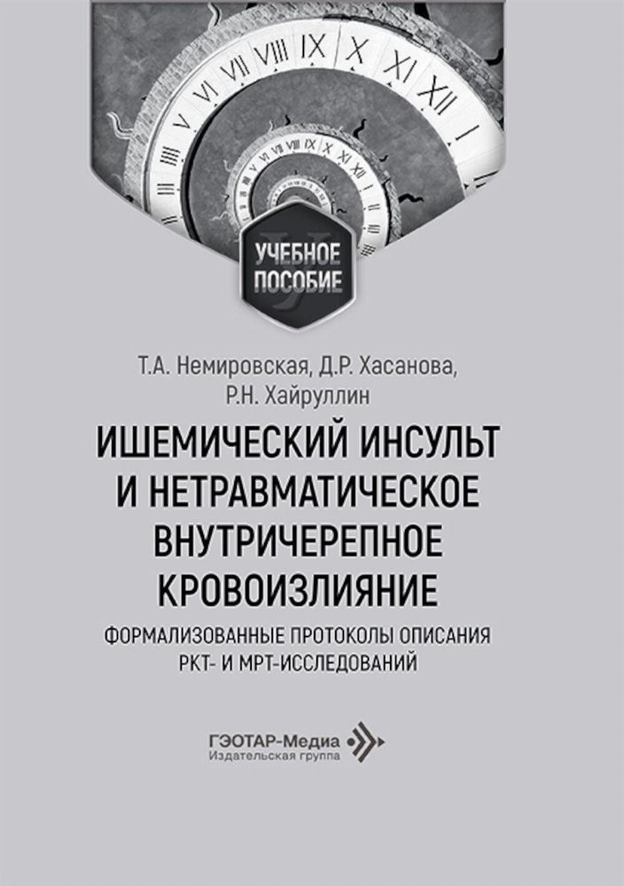 Ишемический инсульт и нетравматическое внутричерепное кровоизлияние