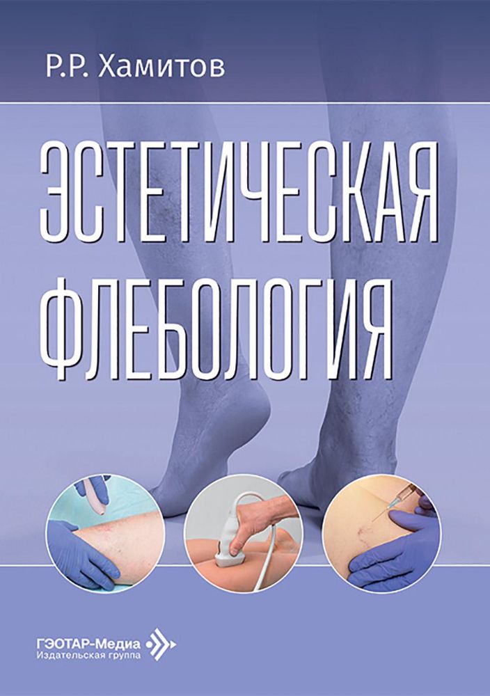 Эстетическая флебология