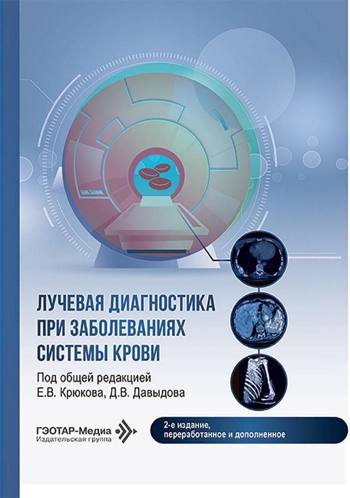 Лучевая диагностика при заболеваниях системы крови . 2-е изд., перераб. и доп