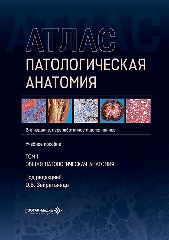 Патологическая анатомия. Атлас. В 2 т. Т. 1: Общая патологическая анатомия: Учебное пособие. 2-е изд., перераб. и доп